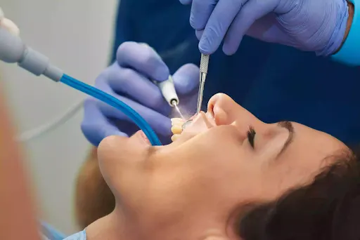 ponerme brackets si tengo dientes picados caries lima peru copia