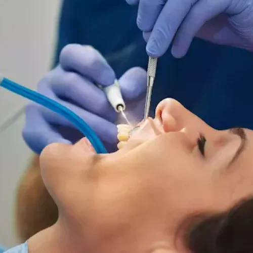 ponerme brackets si tengo dientes picados caries lima peru copia